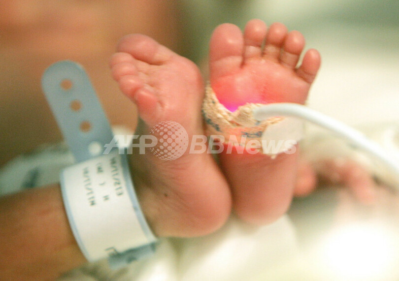 生きた赤ちゃんを袋に入れ捨てる 死産と誤認 中国病院 写真1枚 国際ニュース Afpbb News
