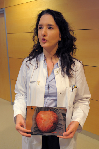 肥満と誤診の女性から28キロの腫瘍摘出