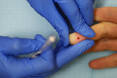 色の変化で体内の薬剤濃度を判定、分子開発 国際研究