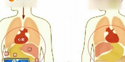 中国人女性 臓器が全て左右逆と判明 100万分の1の発生率