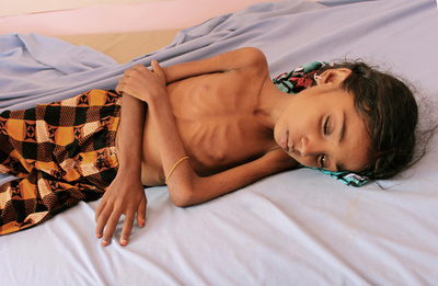 「痩せた身体」