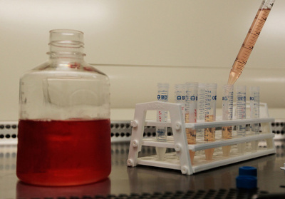 抗HIVワクチンの臨床試験、失敗判明で中止に 米国