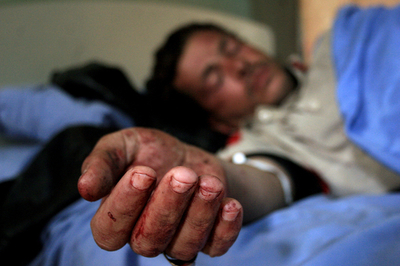 バグダッドの市場での連続自爆攻撃、実行犯は知的障害のある女性