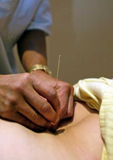 盧元大統領の肺に7センチの針、韓国東洋医学界に波紋