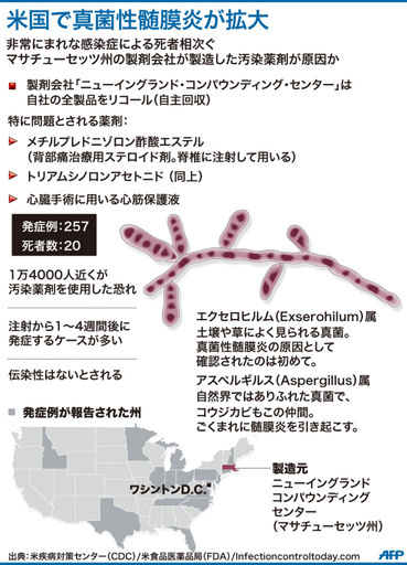 【図解】米国で拡大する真菌性髄膜炎