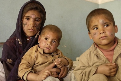 「顧みられない熱帯病」3種に単一の新薬、実験で有効性 研究