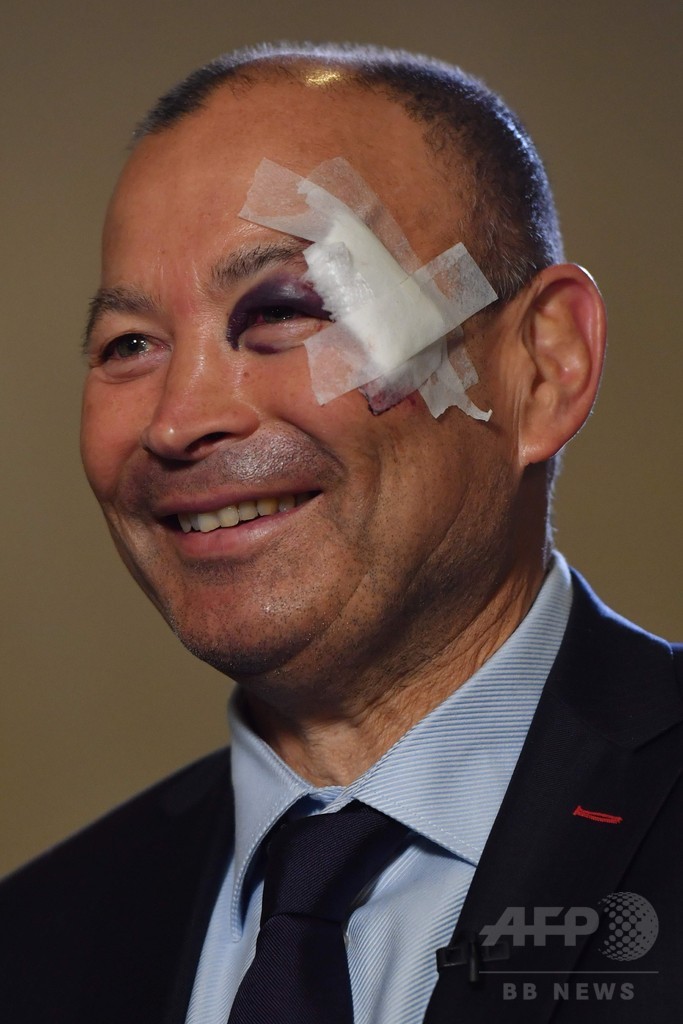 エディーHCが痛々しい顔で登場、けがの理由ははぐらかす