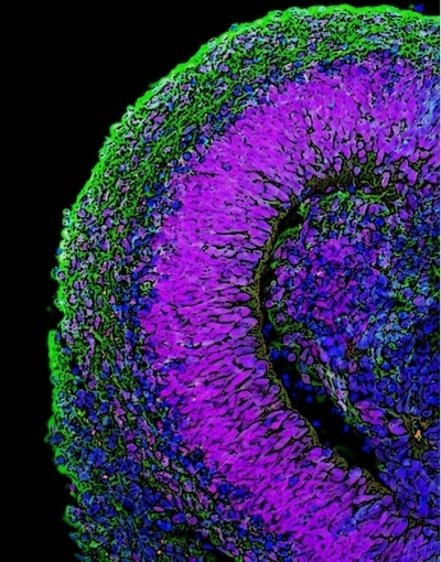幹細胞を使った臨床試験、英国で開始へ 脳卒中と失明の患者を対象に