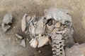 仏東部のアルザス地方で見つかった人骨。負傷の痕が確認できる（2016年6月7日提供）。(c)AFP/INRAP / Michel Christen