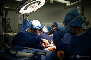 脳死状態の患者にブタの肝臓移植 中国の医師団発表