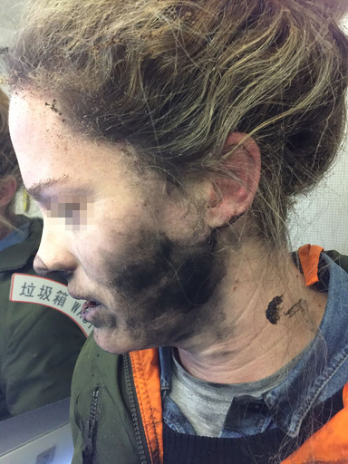 機内でヘッドホンが発火、乗客がやけど 電池が原因か