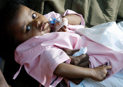 ラクシュミちゃんが四肢分離手術後初めて公の場に、一部医師らは病院を非難