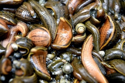 60代女性、半月も咳止まらず検査したら気管に8センチのヒル 中国雲南省