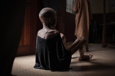 「飢餓による苦しみ」