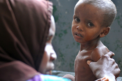 【写真特集】東アフリカで深刻な干ばつ、内戦と二重苦のソマリアで大量の難民