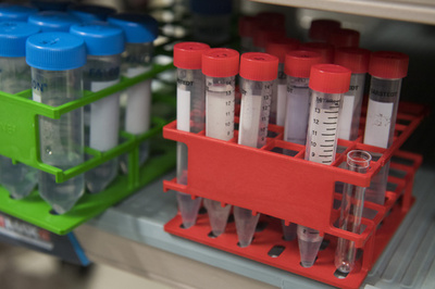 HPVウイルスによるがんの92％、ワクチン接種で予防可能 米CDC