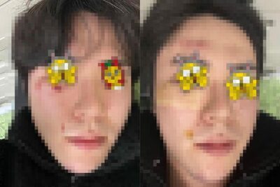 韓国・旧正月で親戚との会合のあと…「道をふさいだ」でトラブル、30人に集団暴行されたという悪夢