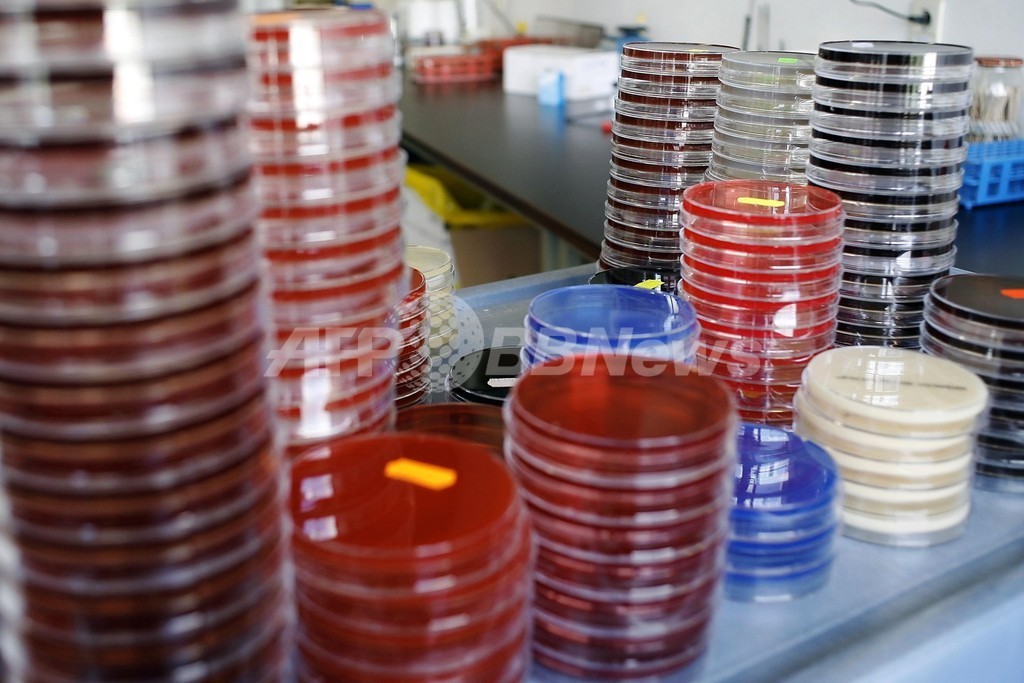 薬剤の併用で耐性獲得細菌に作用、米研究 薬剤の併用で耐性獲得細菌に作用、米研究