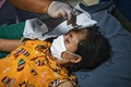 ミャンマー東部カイン（カレン）州での空爆後、タイに逃れて病院で手当てを受ける人（2021年3月30日撮影）。(c)Lillian SUWANRUMPHA / AFP