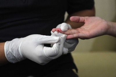 血液1滴で敗血症を迅速に診断、最新検査法 米研究