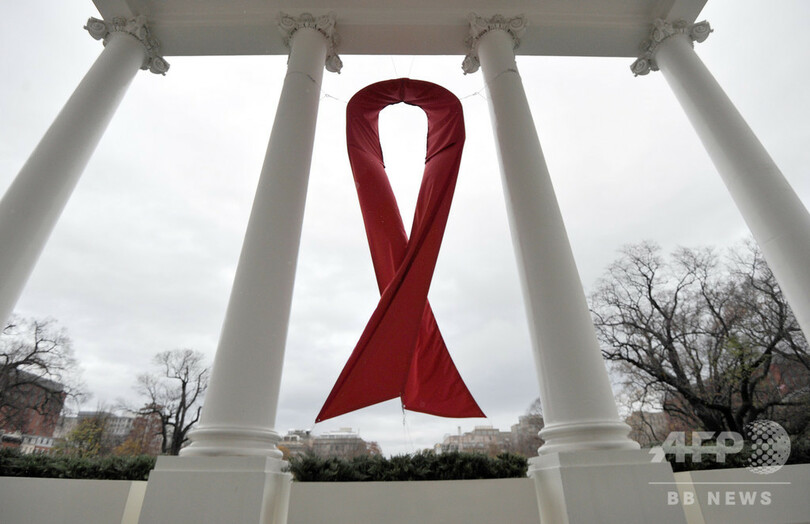 2人目のHIV寛解、エイズ研究に光