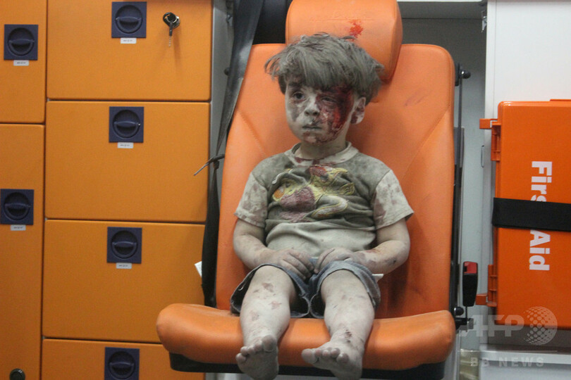シリア少年の衝撃映像に中国メディアが 疑念 写真3枚 国際ニュース Afpbb News