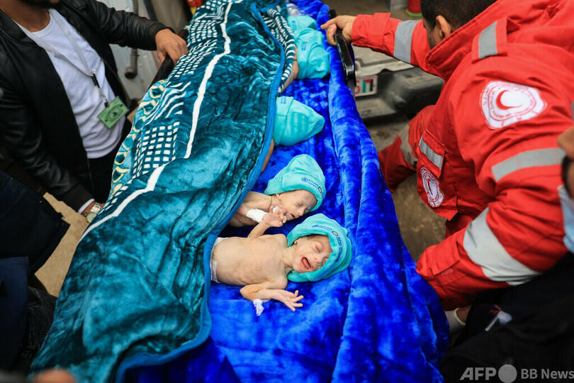 ガザ人道状況、母子にとって「悪夢」 麻酔不十分の帝王切開も