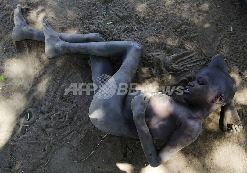 ウガンダの子供たちを襲う謎の奇病「うなずき病」、原因も治療法も不明