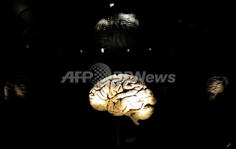 米政府、脳波検査用いたADHD診断を初承認