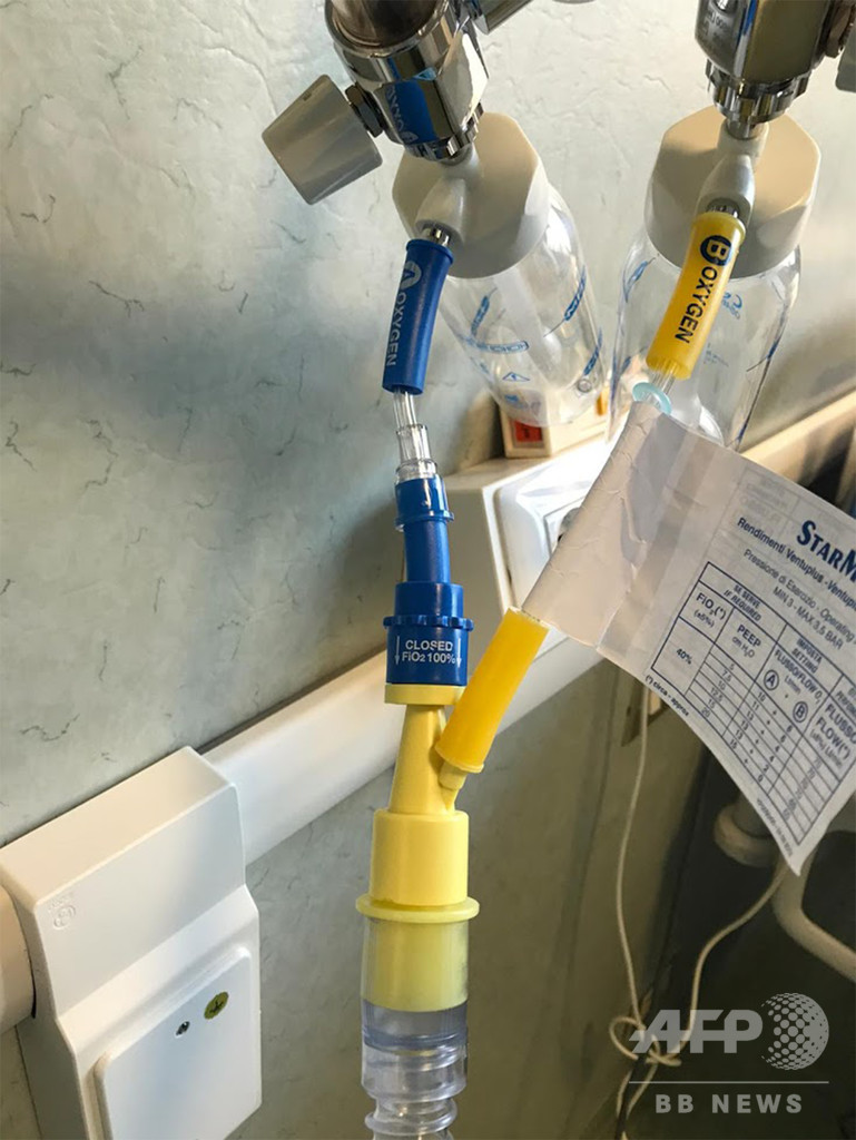 新型コロナで不足する医療器具、解決策は3Dプリンターか