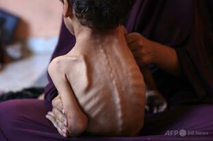 ガザ住民の約3分の1「何日も食べていない」 WFP