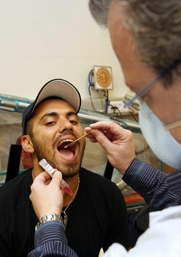 唾液検査でがんを発見、慶大とカリフォルニア大が共同開発