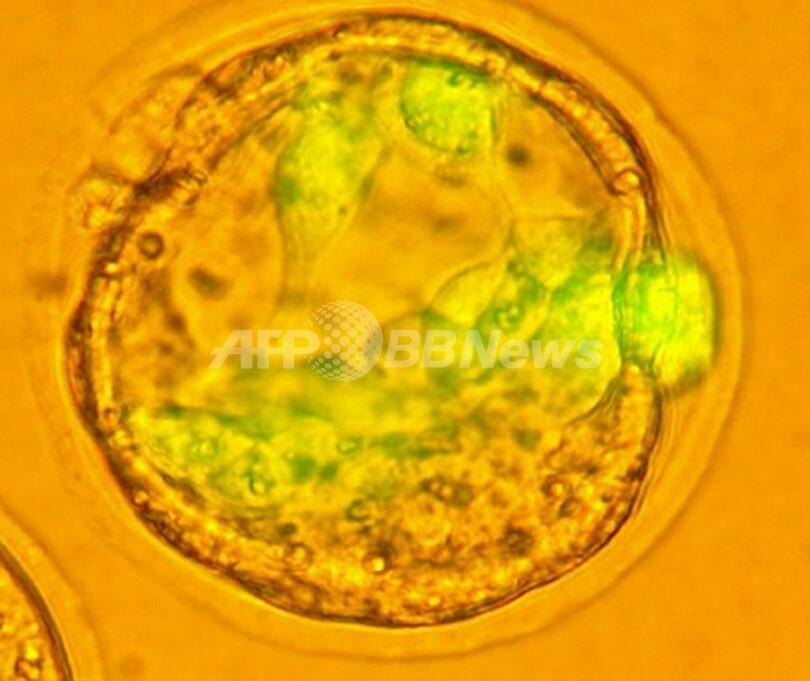医療現場で役立つオワンクラゲの「GFP」、ノーベル化学賞