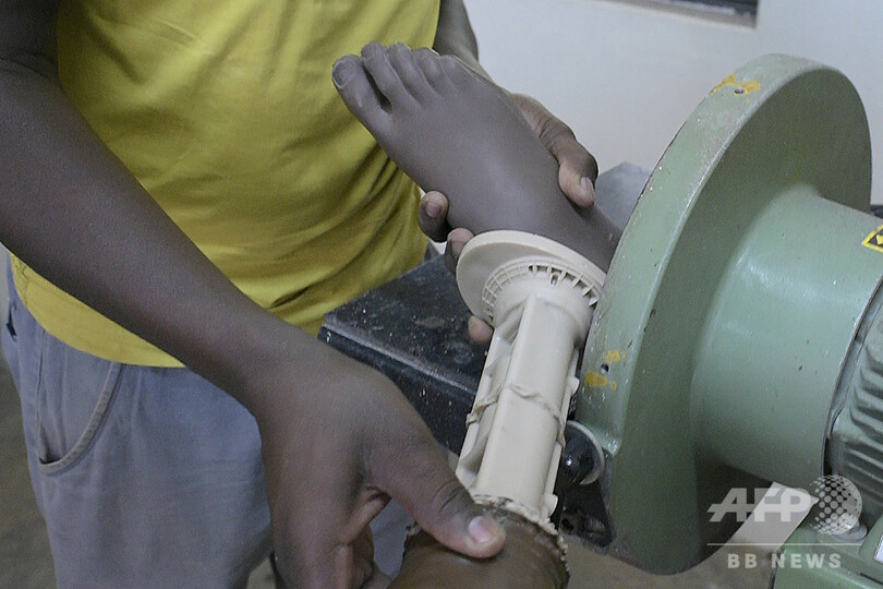 内戦で数万人が手足失い…全国から義肢求めて訪れる施設 南スーダン