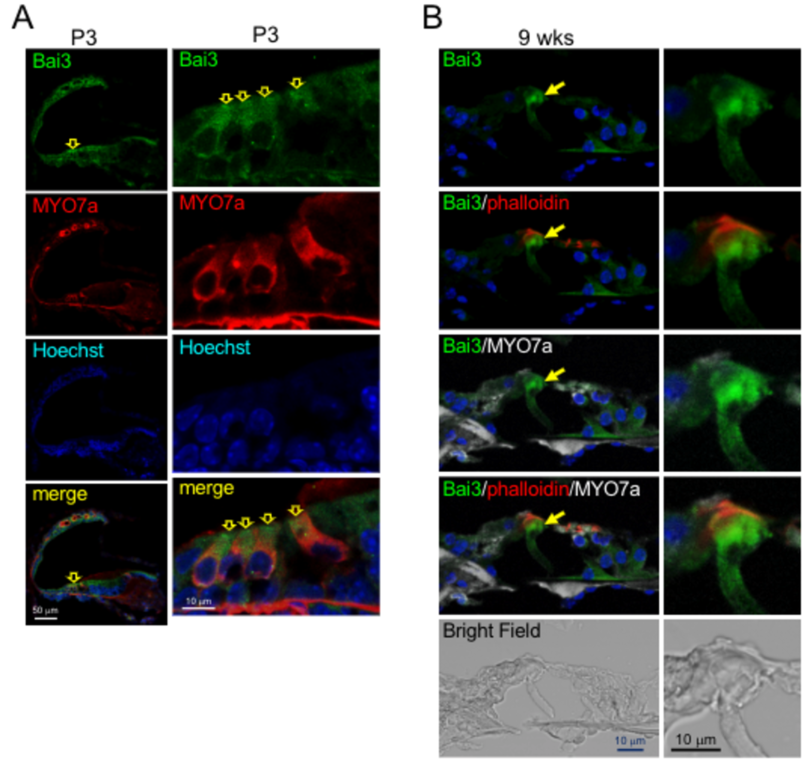 Gタンパク質共役型受容体Bai3欠損マウスは蝸牛形成異常と難聴を呈する音を感知する末梢感覚器が、強くしなやかな構造を維持するメカニズムの