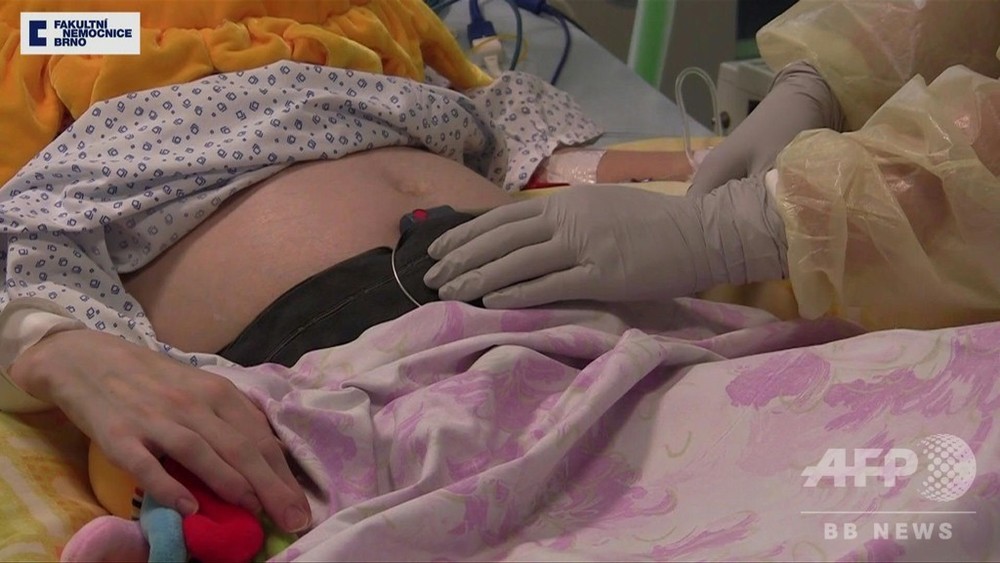 動画 脳死した母親 最も成熟度の高い 水準の女児出産 出産前後の映像 チェコ 写真1枚 国際ニュース Afpbb News