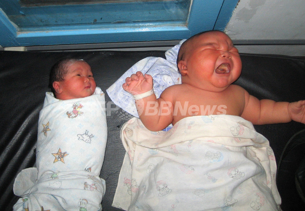 体重8 7キロの新生児が誕生 インドネシア 写真5枚 国際ニュース Afpbb News