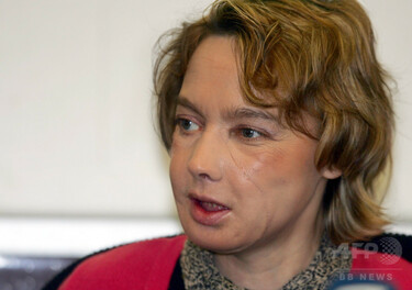 世界初の顔面移植患者が死亡 仏女性、手術から10年余り 写真6枚 国際