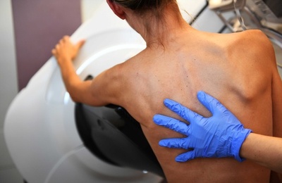 「タトゥー」でがん検出、実験的技術を開発 スイス研究