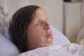 公開されたチャーラ・ナッシュ（Charla Nash）さんの写真（2011年8月11日公開）。(c)AFP/Brigham and Womens Hospital, by Lightchaser Photography