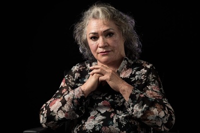 酸攻撃の被害女性、苦しむ仲間に救いの手 メキシコ