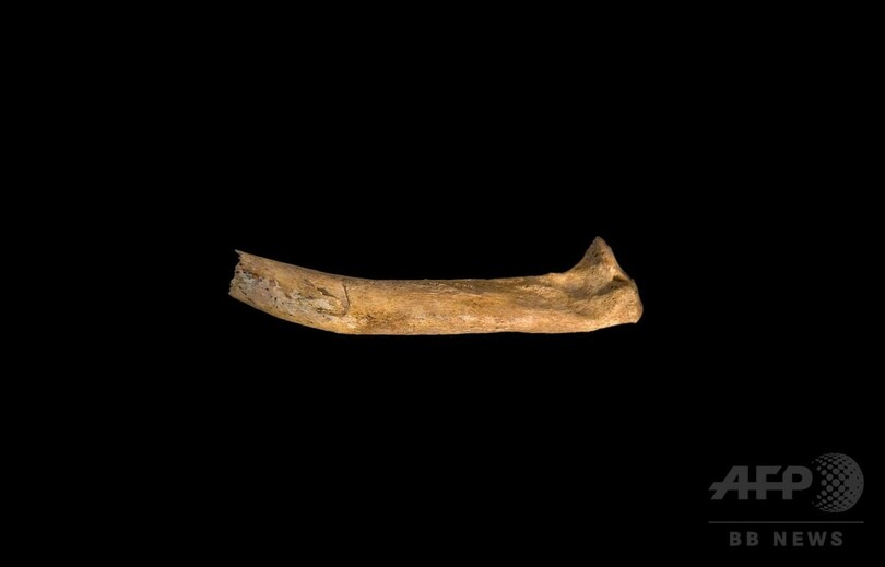 リチャード3世の「凄惨な死」、遺骨から明らかに