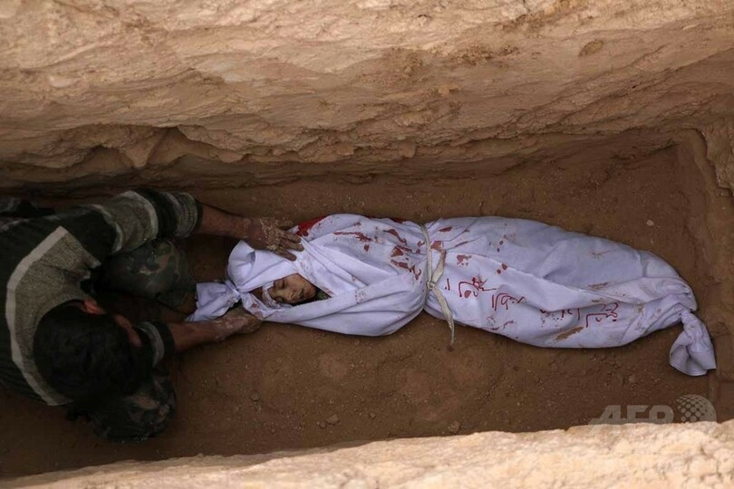 【AFP記者コラム】シリア最大の被害者は子どもたち、無数にいる「オムラン君」
