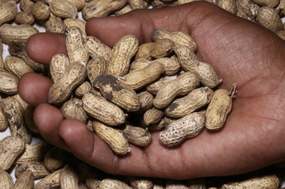 ぜんそく薬ゾレア、食物アレルギーリスクを劇的に低減 研究