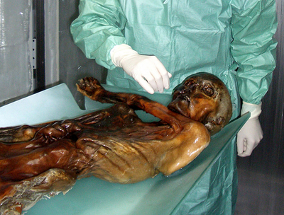 アルプスで発見のミイラ、「アイスマン」は2度襲撃されていた ドイツ研究