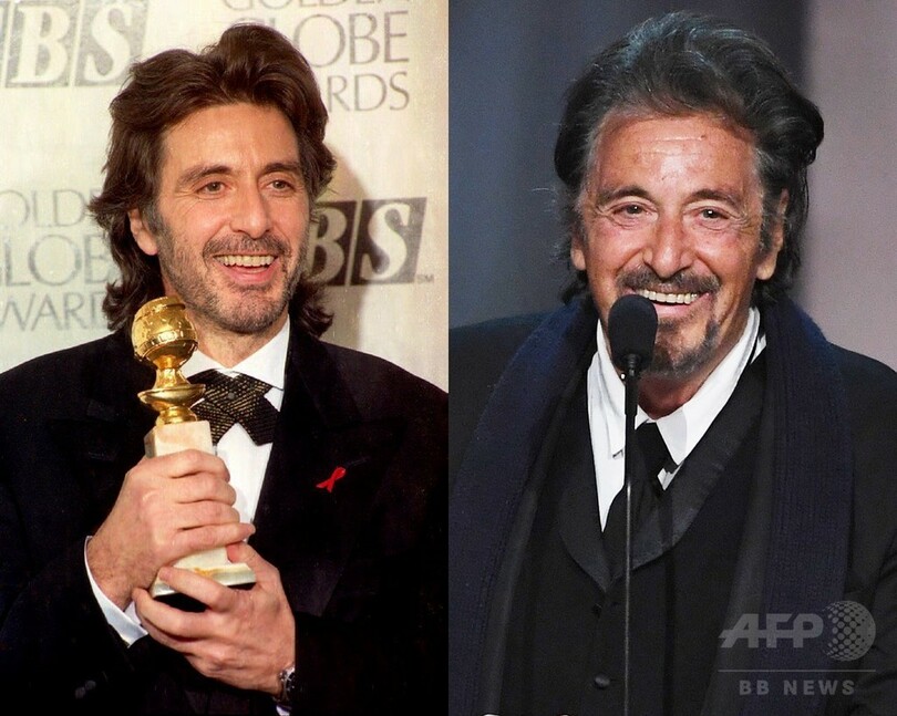 【写真特集】海外男性セレブのビフォーアフター