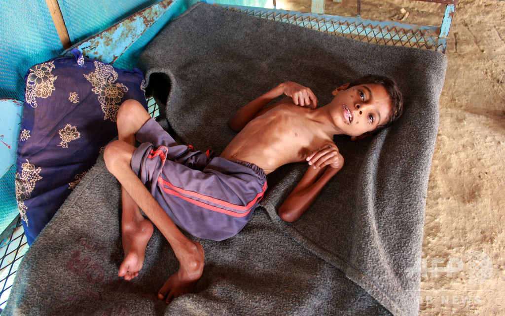 イエメンで1000万人以上が深刻な食糧不足 人道危機が急激に悪化 Wfp 写真7枚 国際ニュース Afpbb News