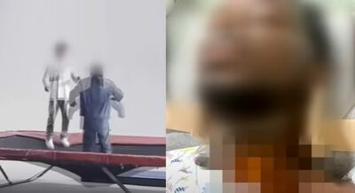 CM撮影中に首の骨を折った外国人モデル…韓国・制作側「それは不運」で責任回避