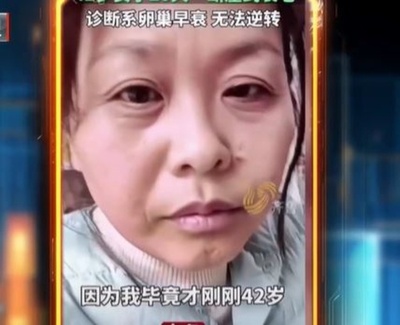 中国の42歳の女性がわずか20日間で急激に老化60代の容貌に 