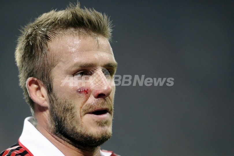 ベッカムがアキレス腱断裂、W杯絶望か